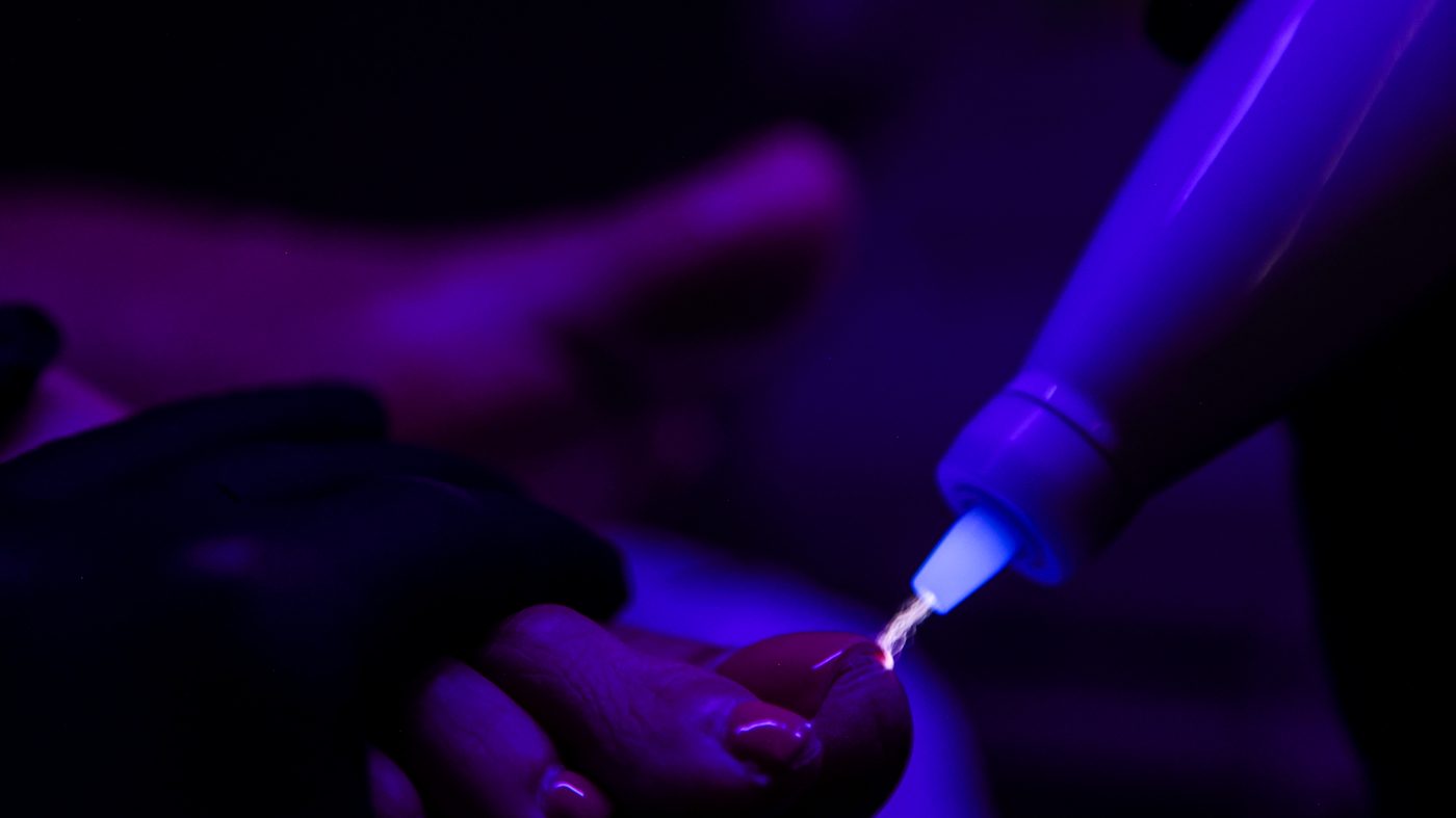 Głowica Plasma Jet podczas pracy przy paznokciu stopy — PLASMAXIS