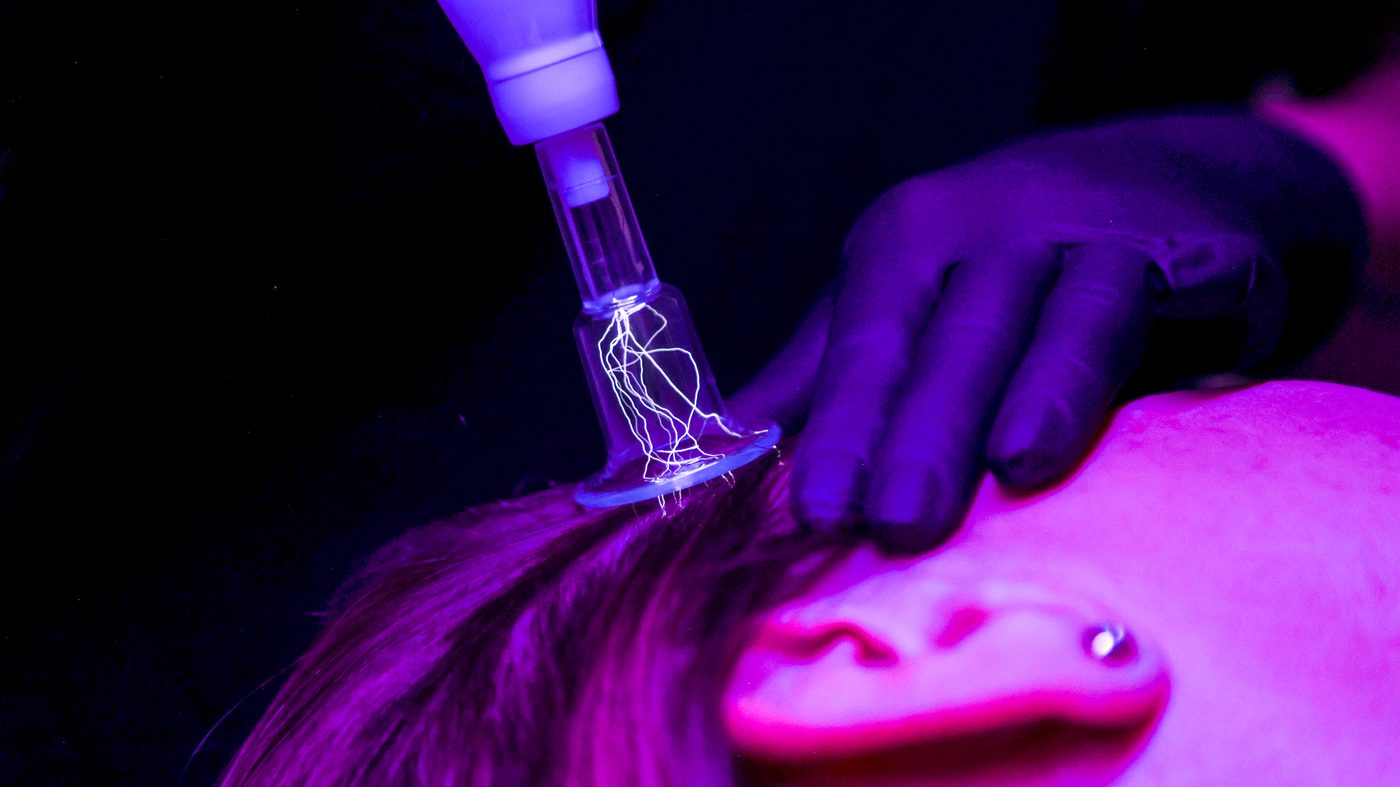 Zimna plazma na skórze głowy — głowica Hyper Plasma z widocznymi wyładowaniami